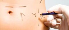 cirurgia-plastica-manaus-1373317519