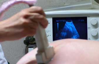 José Araújo Brito - Foto 1