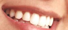implantes-dentarios-manaus-1373392159