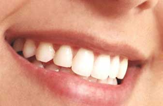 Ability Implante e Odontologia Estética - Foto 1